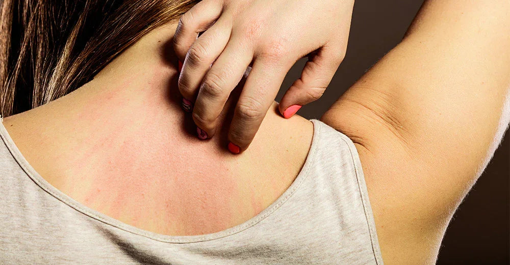 5 Reasons Why You are Allergic to Certain Clothing and What You can do – Cottonique - Allergy-free Apparel