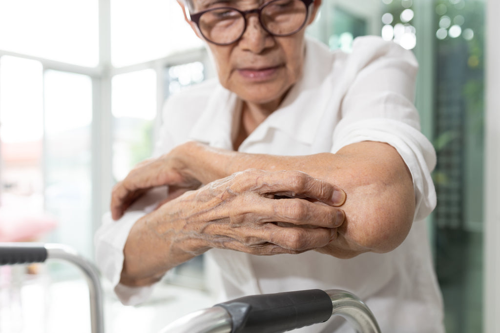 5 Common Skin Conditions in the Elderly