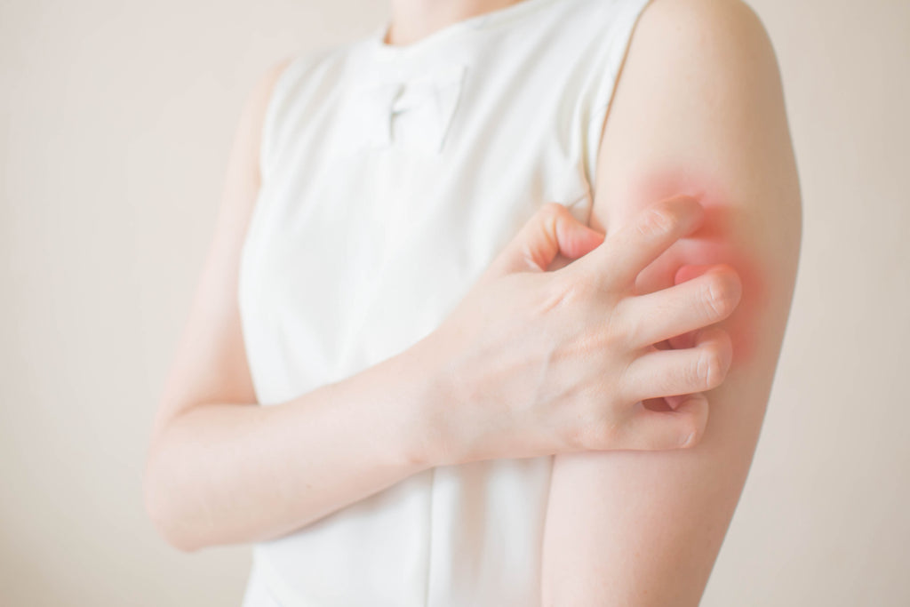 Irritant VS. Allergic Contact Dermatitis: What's the Difference?