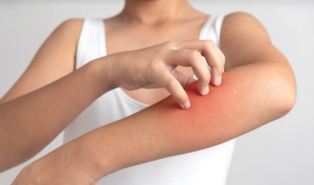5 Effective Tips to Treat Dry, Itchy Skin at Home