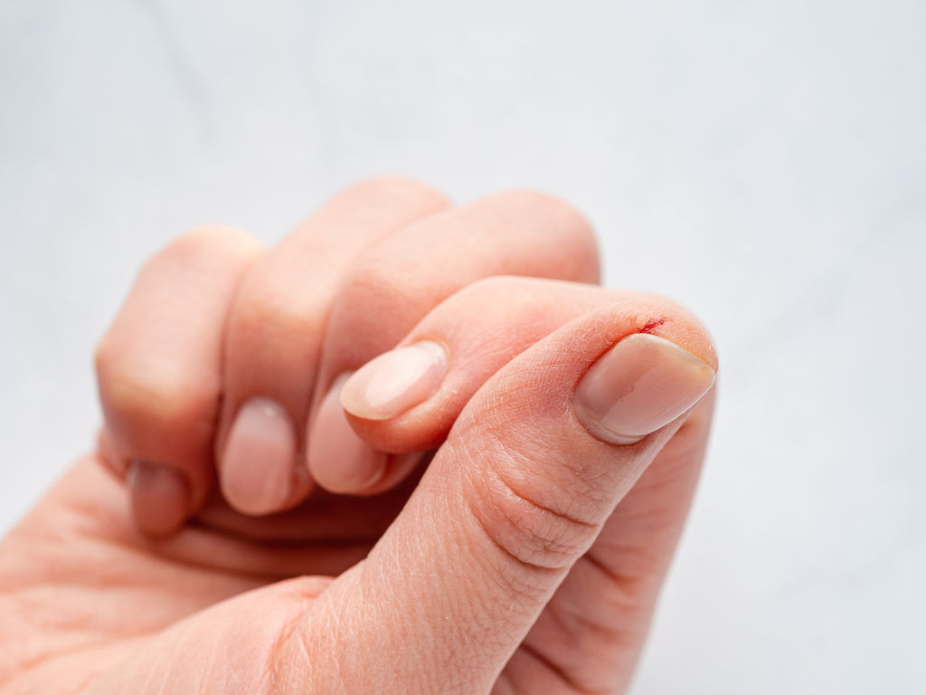 Dry and Cracked Fingertips? Here's How to Heal Them